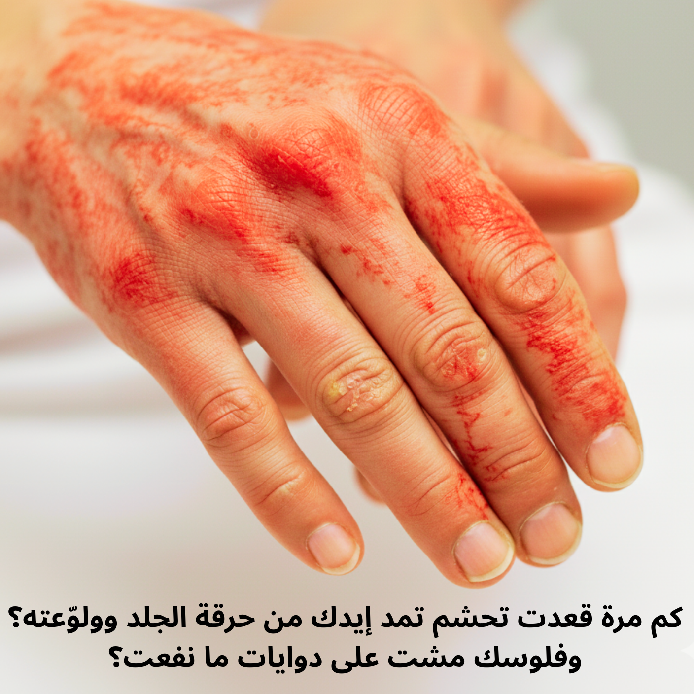 كريم الأعشاب الصيني التقليدي الأصلي (15 جرام)